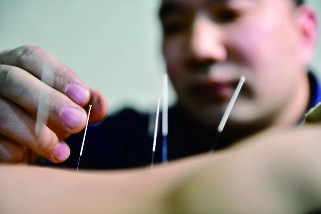 《金村郭氏中医针灸》申请非物质文化遗产大获成功